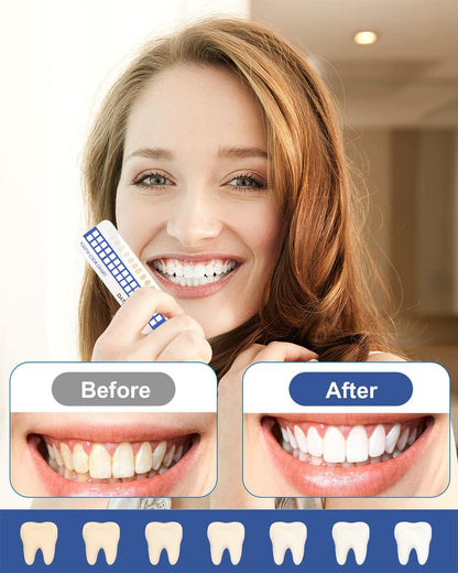 Teeth Whitening Kit with LED Light for Sensitive Teeth and Tooth Whitening System, Home Teeth Whitener with 3 Teeth Whitening Gel Refill Pens, Color Plate, Tray - White